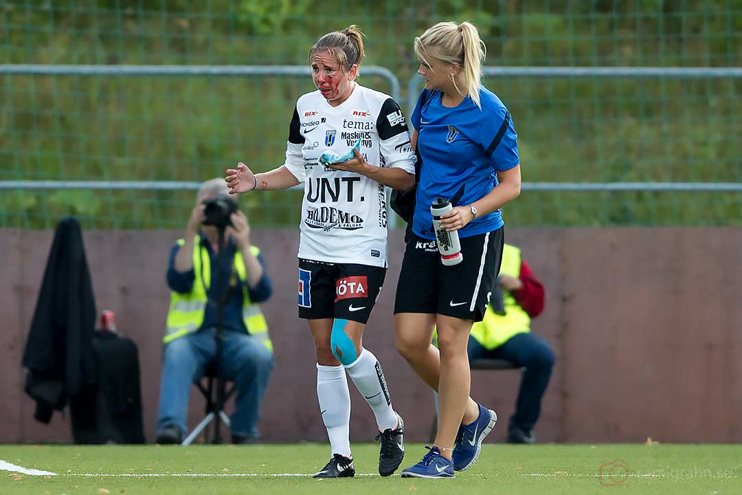 Sirius Sarah Elnicky med blodiga ansiktsskador